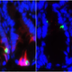 The image on the left shows mice stem cells (red) being killed (green) by chemotherapy. The image on the right shows some stem cells protected by the PUMA inhibitor even with chemotherapy treatment. Image: Science Translational Medicine/Jian Yu.